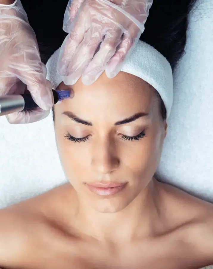 image of a lady having a Derma FNS™ Pen treatment.